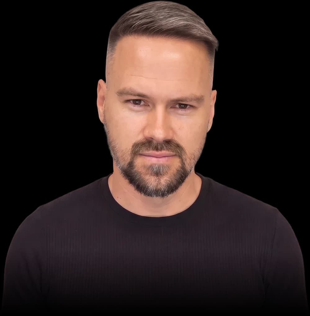 Klient NewLooks po transplantaci vlasů